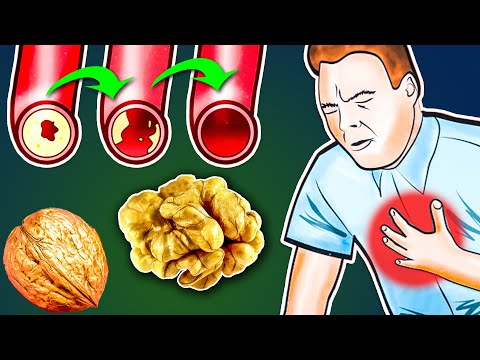 Видео: Вот что творит обычный Грецкий орех, если Есть его Каждый день!