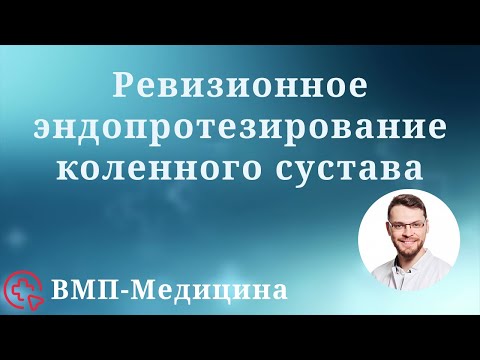 Видео: Ревизионное эндопротезирование коленного сустава | ВМП-Медицина