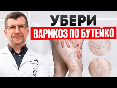 Видео: Как устранить варикоз и геморрой помогает метод Бутейко. Воспаление вен, отёки, флебит, боль, тромбы