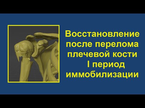 Видео: 1. Восстановление после перелома верхней трети плечевой кости. Период иммобилизации.