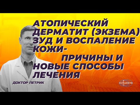 Видео: Атопический дерматит (экзема), зуд и воспаление кожи- причины и новые способы лечения.