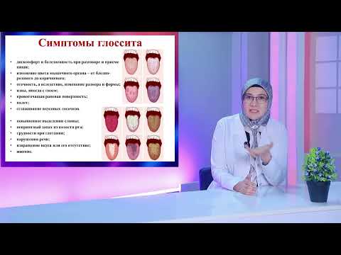 Видео: Глоссит: причины, симптомы, диагностика и лечение
