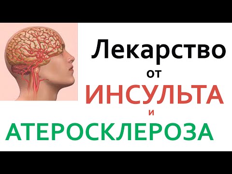 Видео: Все врачи знают!!! Оксид азота- лекарство от ИНСУЛЬТА и АТЕРОСКЛЕРОЗА