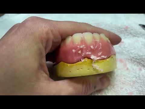 Видео: Моделировка съёмного протеза