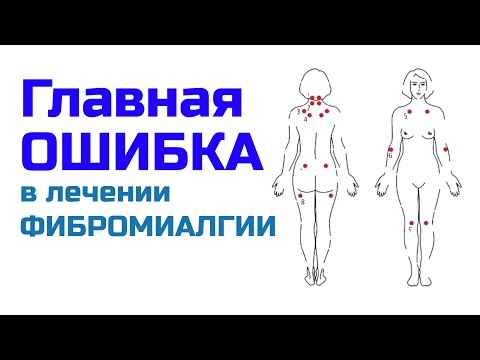 Видео: Как лечить фибромиалгию ? Главное упущение в лечении