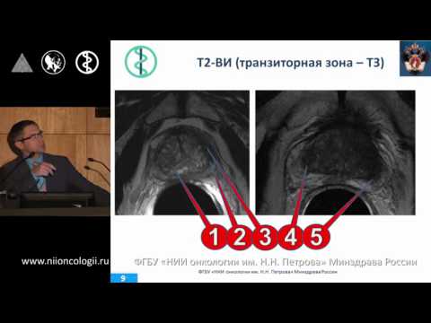 Видео: Рак предстательной железы: интерпретация МРТ на основе системы PIRADS. Мищенко А.В.