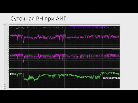 Видео: Кайбышева В.О., Куваев Р.О. Аутоиммунный гастрит. Запись лекции