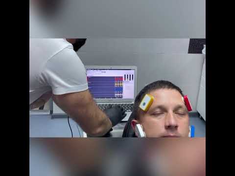 Видео: Стоматологический Электромиограф и его применение на практике .