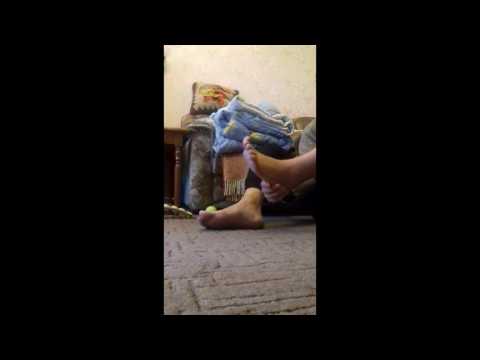 Видео: Разрыв ахилла. Реабилитация после разрыва ахилового сухожилия(Ахилла).