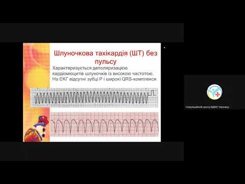 Видео: Види зупинки кровообігу. Теорія та практика роботи з дефібрилятором