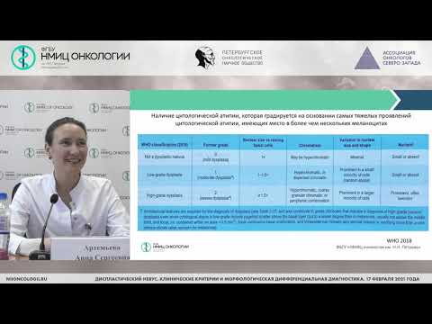 Видео: Гистологические критерии диспластического невуса (Артемьева А.С.)