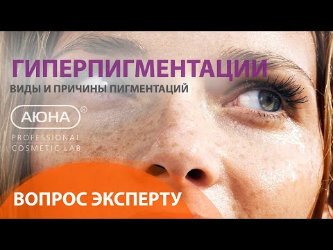 Видео: ГИПЕРПИГМЕНТАЦИИ: вопрос ЭКСПЕРТУ