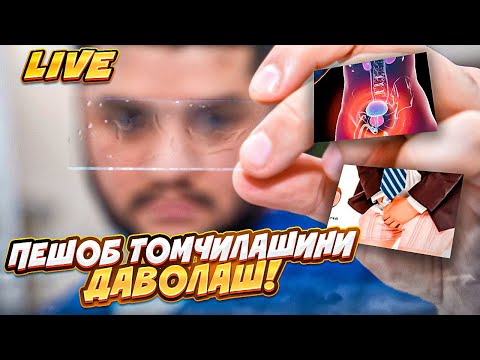 Видео: Сийганда ачишиш ва томчилаш давоси