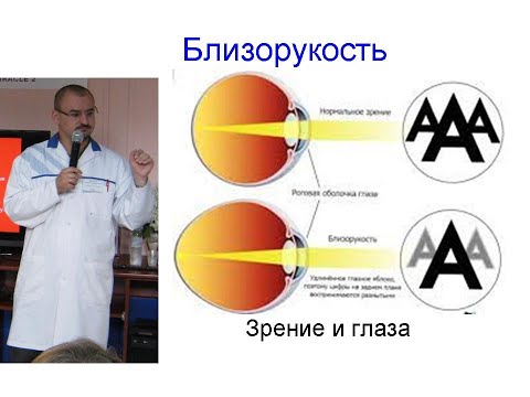 Видео: Близорукость. Спазм аккомодации. Минусовые очки.