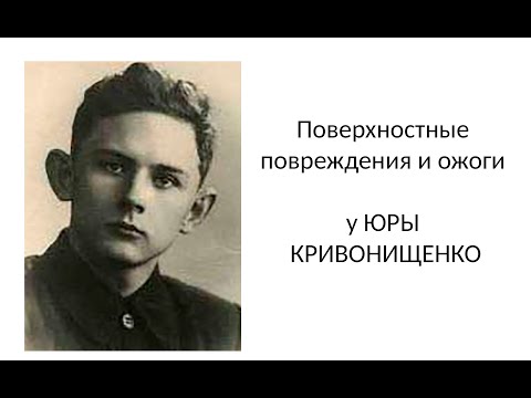 Видео: Поверхностные повреждения и ожоги у Юрия Кривонищенко