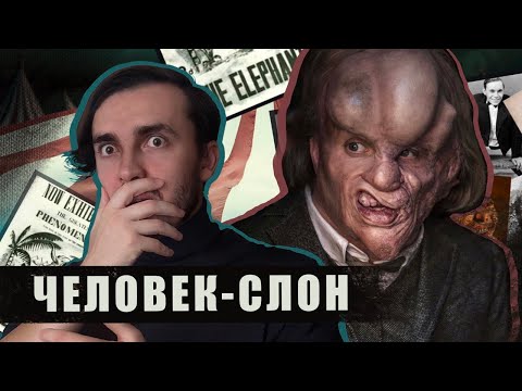 Видео: Человек СЛОН: Выиграть генетическую лотерею и умереть молодым - [История Медицины]