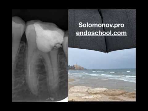 Видео: Разбор клинического случая: Сломанный инструмент