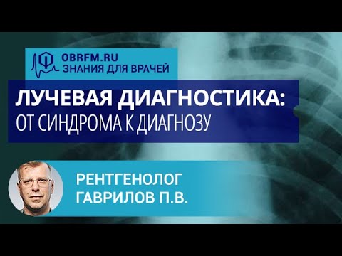 Видео: Рентгенолог Гаврилов П.В.: Лучевая диагностика: от синдрома к диагнозу. Кольцевидная тень в легком