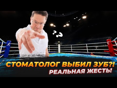 Видео: Стоматолог выбил зуб? Цена одной ошибки. Реальный клинический случай моего пациента