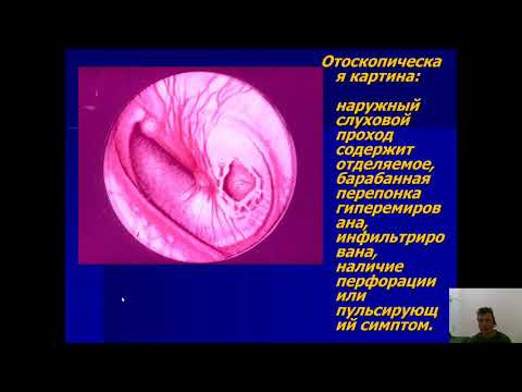 Видео: Оториноларингология 1.Острый средний отит и отогенные внечерепные осложнения