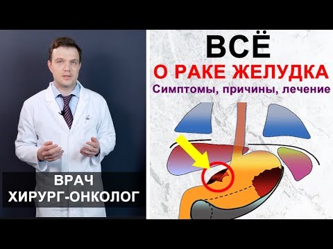 Видео: Рак желудка - симптомы, причины, лечение рака желудка. Максимально подробно