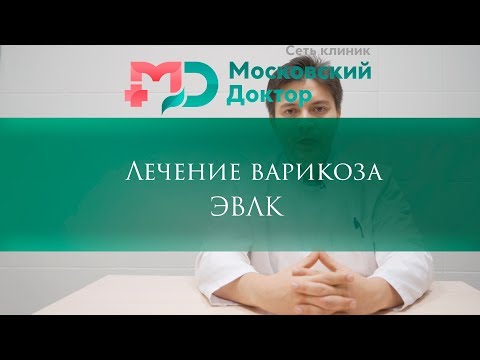 Видео: Лечение варикоза (ЭВЛК)