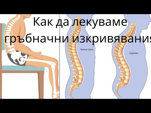 Видео: Гръбначни изкривявания и прегърбени рамене лекуване с упражнения вкъщи