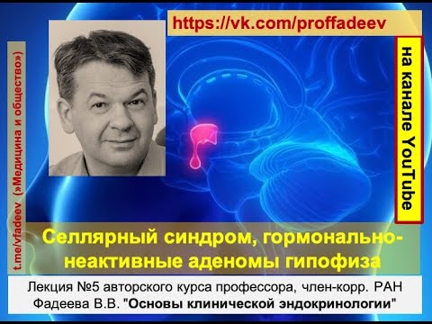 Видео: Селлярный синдром, гормонально-неактивные аденомы гипофиза