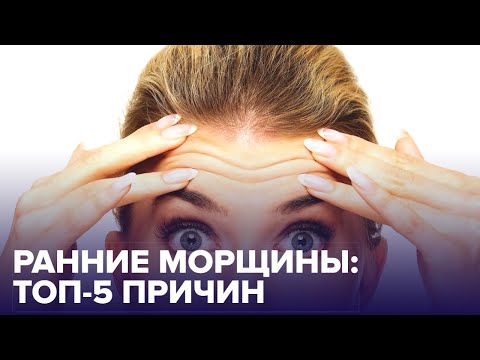 Видео: Ранние МОРЩИНЫ. Почему появляются и что делать?