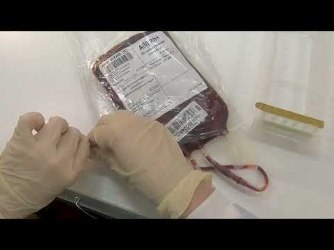 Видео: Проба на совместимость в непрямом антиглобулиновом тесте