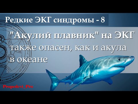 Видео: Паттерн в виде «акульего плавника».