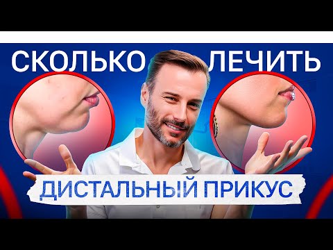 Видео: За какое ВРЕМЯ можно исправить дистальный прикус?