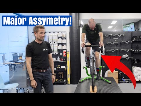 Видео: Велосипедная подгонка, которая избавила от 8-летней боли в ногах