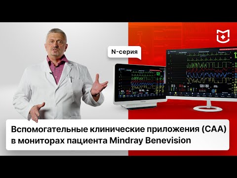 Видео: Вспомогательные клинические приложения (CAA) в мониторах Mindray Benevision N-серии