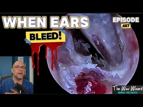 Видео: КОГДА КРОВЬ ИЗ УШЕЙ! Эпизод 487