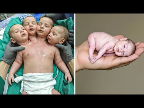 Видео: 10 самых странных детей, о существовании которых вы даже не могли себе представить.