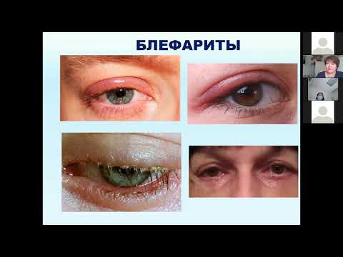 Видео: Вебинар "Актуальные вопросы офтальмологии в педиатрической практике" 08.10.2020