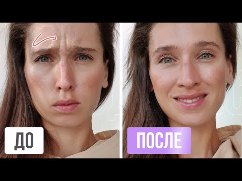 Видео: МЕЖБРОВКА УЙДЁТ за 20 МИНУТ | Простые упражнения от межбровных морщин на лбу в домашних условиях