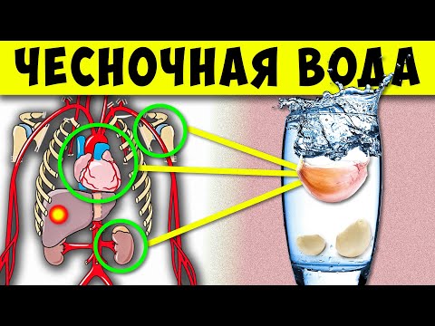 Видео: Вот что Творит, Чесночная Вода, если пить Каждый день 2 недели