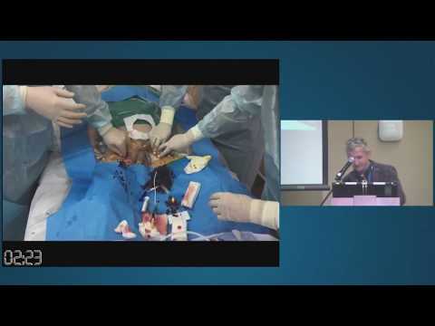 Видео: Первые результаты работы Центра ЭКМО многопрофильного стационара Кецкало М.В.