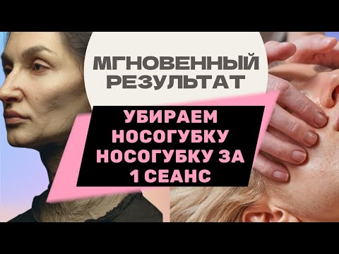Видео: Убираем носогубку за 1 сеанс!