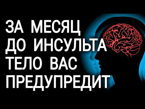 Видео: Перед инсультом ваше тело предупредит вас