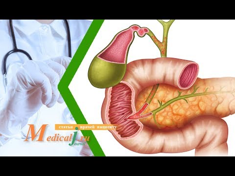 Видео: Холангит. Какие причины? Какие симптомы? Как лечить?