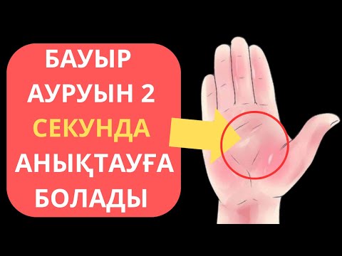 Видео: Бауыр ауруы белгилери ТОП 5. БАУЫР ауыратынын 2 секундта тез тексер.