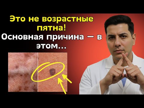 Видео: Пигментные пятна на вашей коже — это тревожный звонок то же самое происходит и с вашим мозгом!