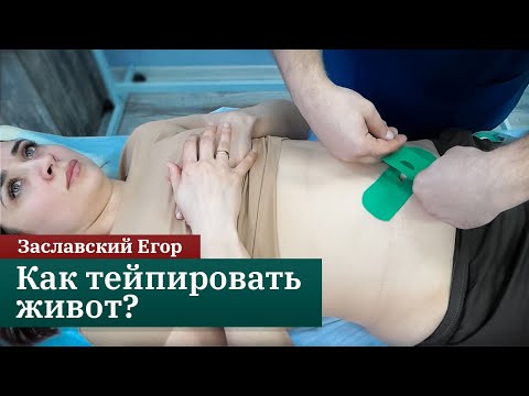 Видео: Тейпирование при диастазе и расхождении пупочного кольца. Заславский Егор