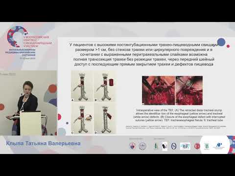 Видео: Трахеопищеводные свищи Клыпа Т.В.