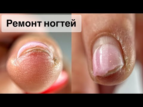 Видео: МАНИКЮР ОНЛАЙН. НАРАЩИВАНИЕ НОГТЯ. ОПИЛ . Виктория Авдеева