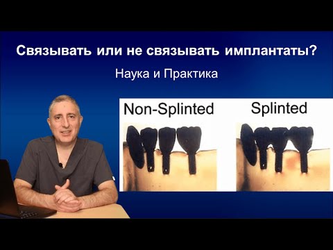 Видео: Что лучше - одиночные коронки на имплантах или мост?