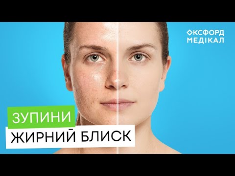 Видео: ТОП-5 помилок у догляді за жирною шкірою, які псують вашу зовнішність!